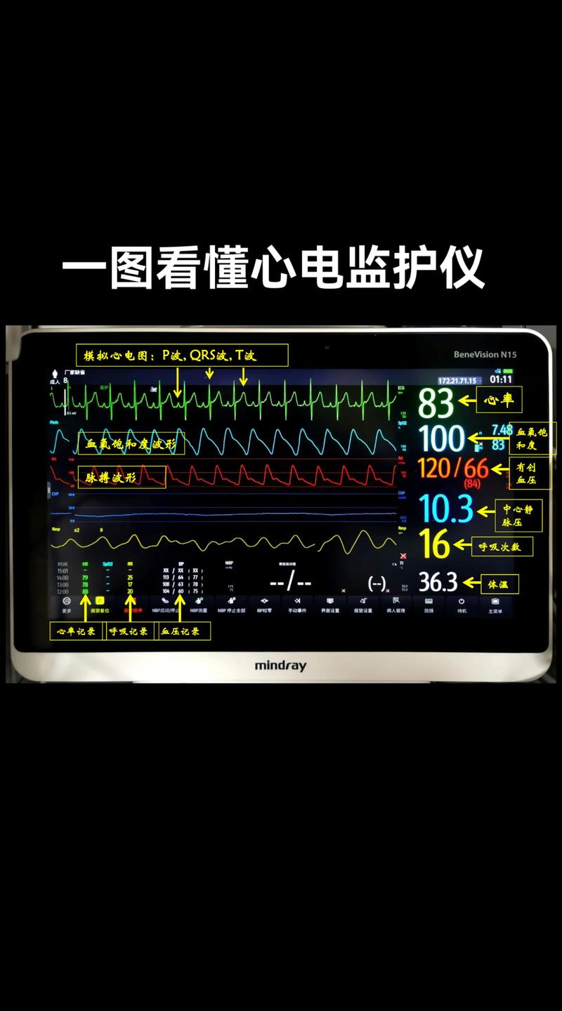 心跳过缓怎么办