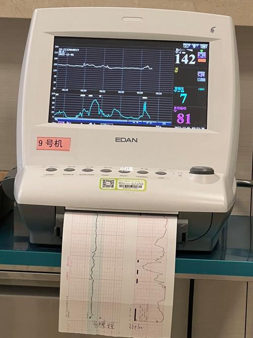 有必要买个胎心仪自己听胎心吗? 有必要买个胎心仪自己听胎心吗?