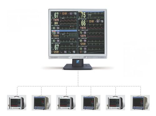 产科中央监护系统产科中央监护系统应用 产科中央监护系统产科中央监护系统应用
