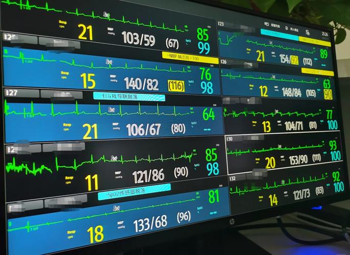 有什么胎心监护仪品牌推荐吗? 有什么胎心监护仪品牌推荐吗?