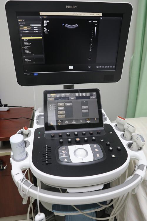 多普勒胎心仪对胎儿有影响吗 多普勒胎心仪对胎儿有影响吗