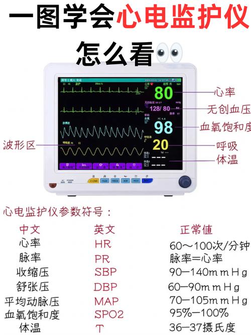 心电监护rpm是什么意思 心电监护rpm是什么意思