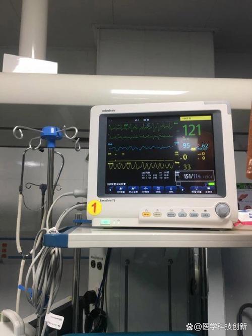 胎心监护仪是什么 胎心监护仪是什么