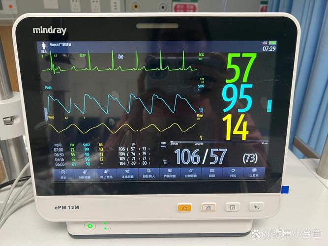 心电监护仪导联线的五个颜色分别在身上的哪几个部位?黑白棕红绿_百度知 ... 心电监护仪导联线的五个颜色分别在身上的哪几个部位?黑白棕红绿_百度知 ...