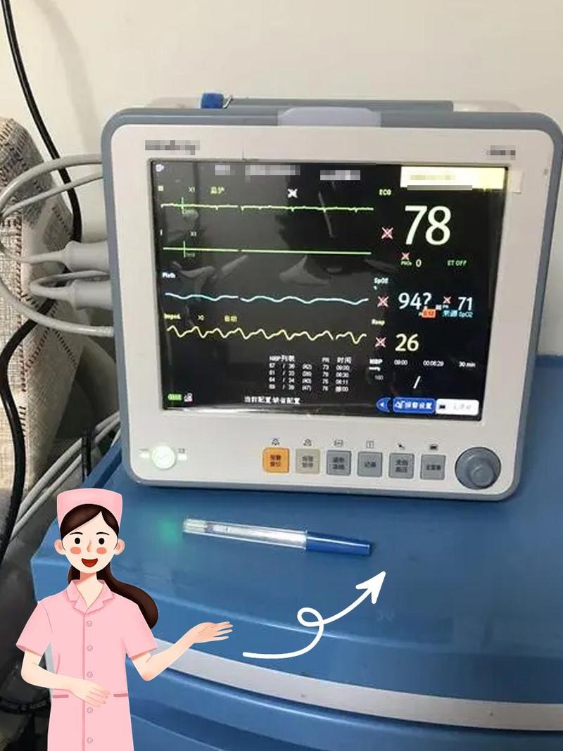 心电监护rpm是什么意思