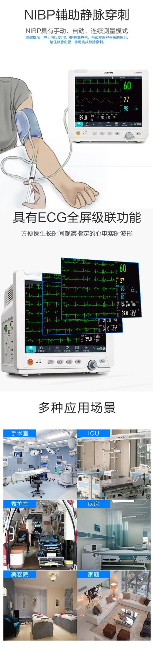 三甲医院的心电监护仪检测项目有哪些?要具体的。 三甲医院的心电监护仪检测项目有哪些?要具体的。