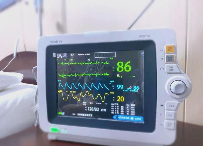 心电监护仪的小秘密