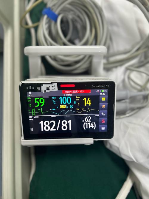 心电监护5个电极贴法 心电监护仪的电极安放位置注意事项 心电监护5个电极贴法 心电监护仪的电极安放位置注意事项