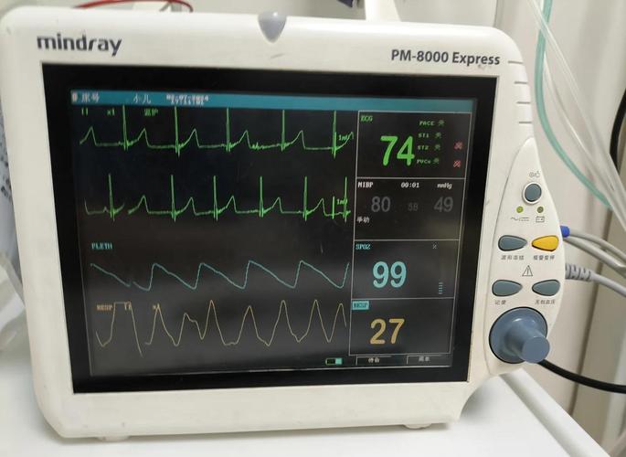 心电监测仪四根线分别表示什么