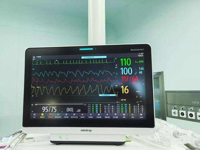 心电监护hr是什么意思 心电监护hr是什么意思