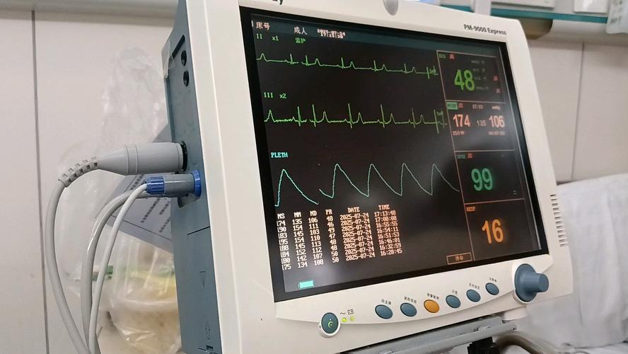 心电监护5个电极贴法 心电监护仪的电极安放位置注意事项 心电监护5个电极贴法 心电监护仪的电极安放位置注意事项