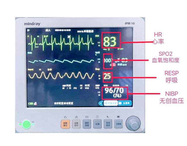 一台心电监护仪多少钱??