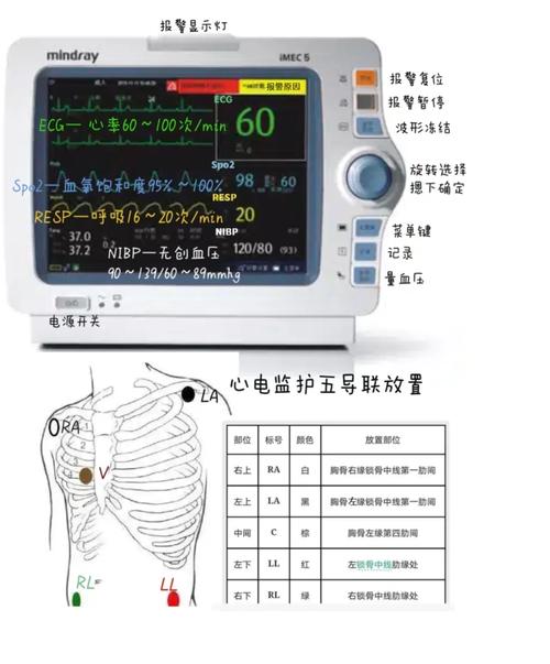护理团建,你不知道的五个阶段 护理团建,你不知道的五个阶段