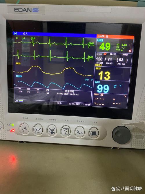 心电监护5个电极贴法 心电监护仪的电极安放位置注意事项